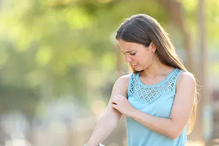 woman scratching from mosquito bite